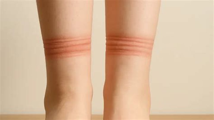 Is it normal for my socks to leave marks
